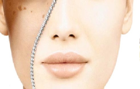 علاج البقع البنية في الوجه بالليزر